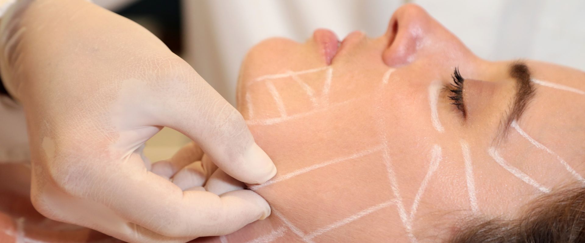 Stimolare il collagene? Facile con gli ultrasuoni