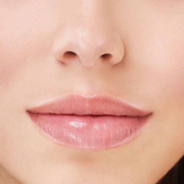 Russian Lips trattamenti labbra in medicina estetica