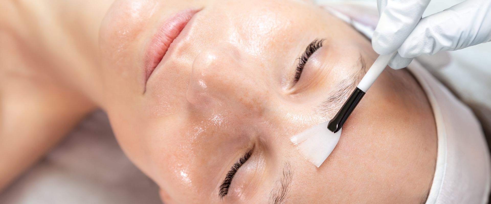 Il potere rigenerativo dei peeling chimici in medicina estetica