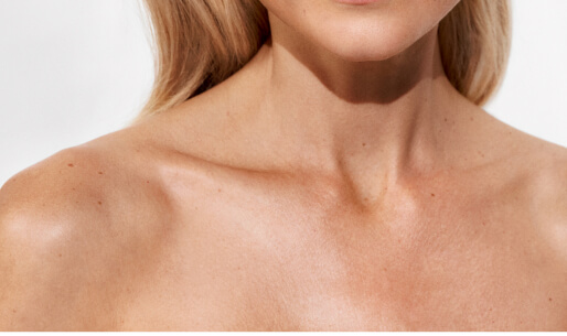 Aree di trattamento Merz Aesthetics Medicina estetica