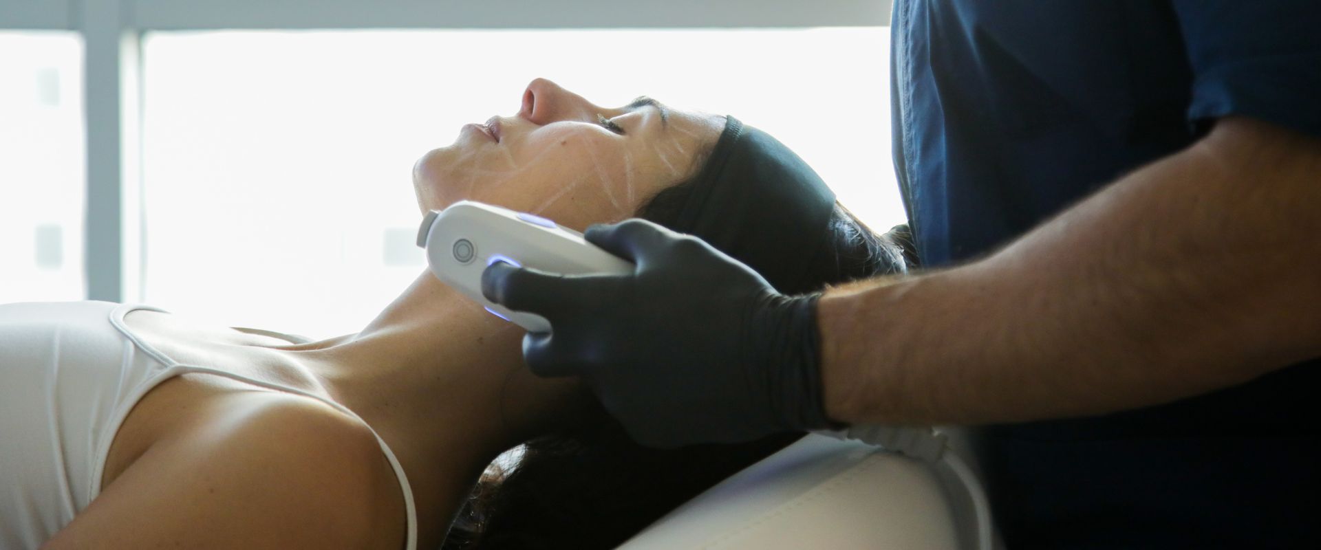Ultherapy PRIME®: il trattamento di ringiovanimento che rinnova la tua pelle