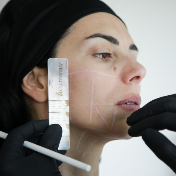 Contouring naturale con Ultherapy PRIME® cosa aspettarsi