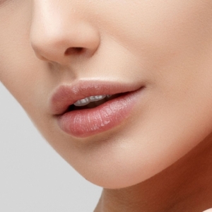 filler labbra