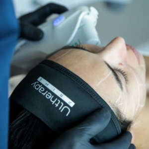 Ultherapy PRIME