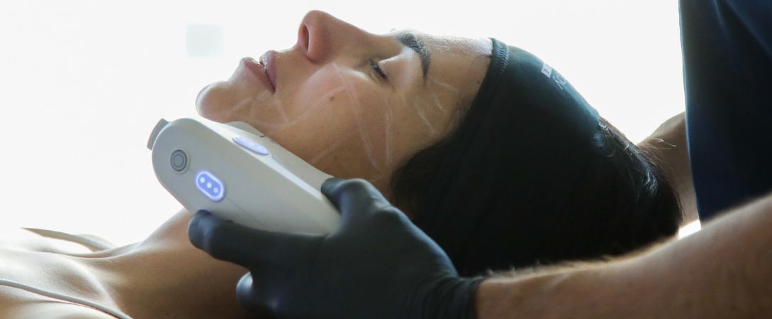 Ultherapy PRIME®: pelle più tonica grazie agli ultrasuoni viso